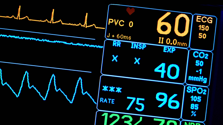 심박측정기 화면
